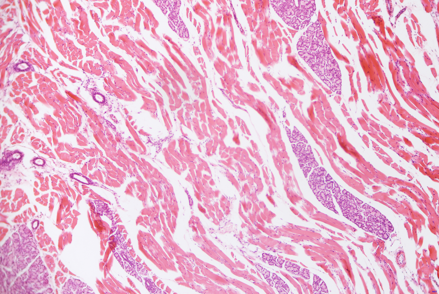 MTR3CMOS应用实例 MTR3CMOS应用实例